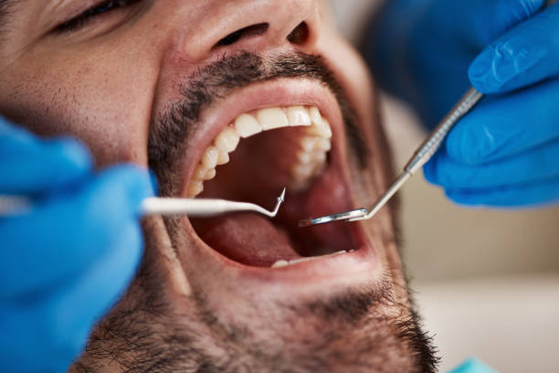 Best Emergency Root Canal Treatment in Balch Springs, TX